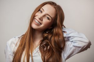 ceramic braces